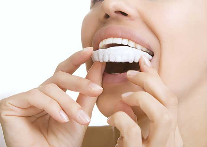 Teeth Whitening Services In Mcallen Tx At Xpress Dental